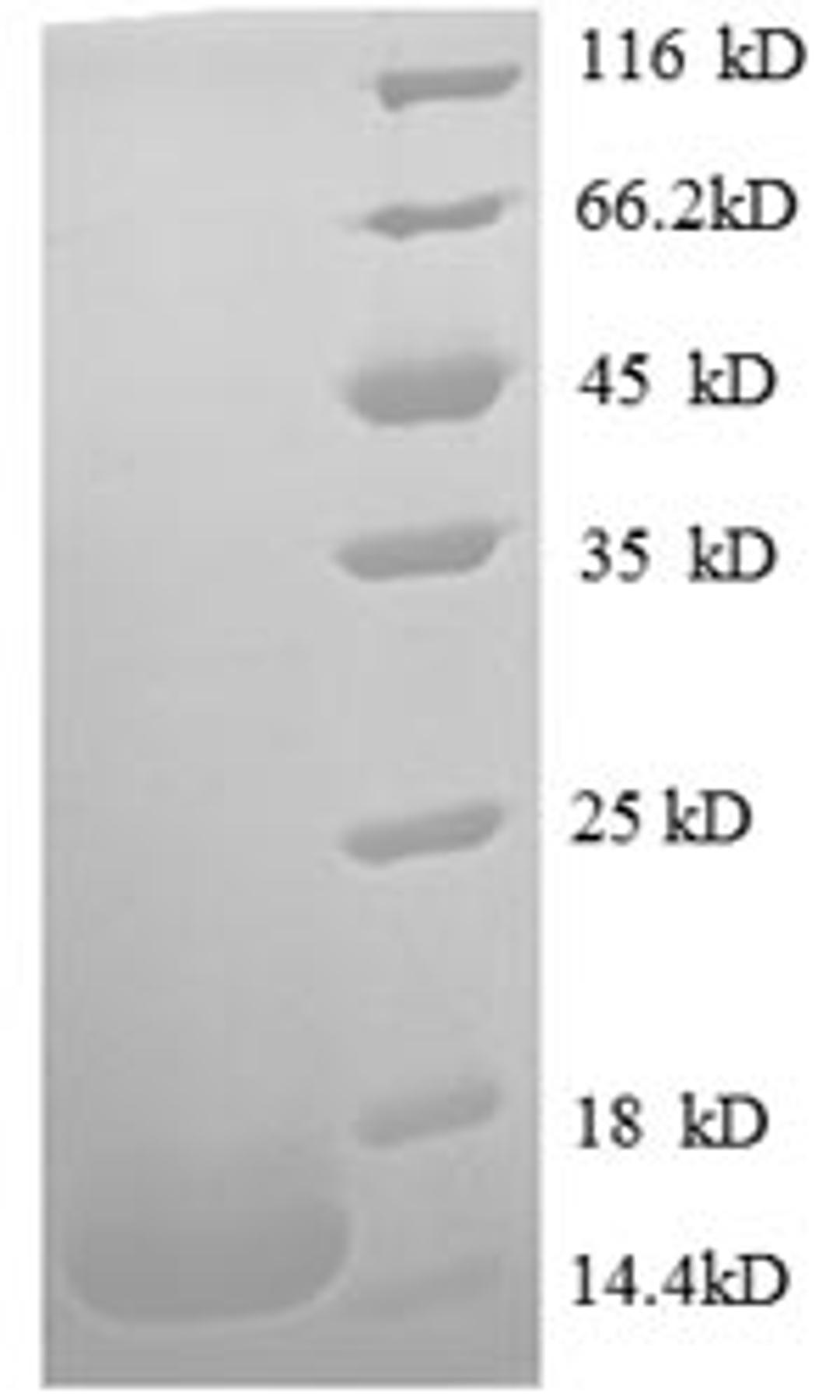 (Tris-Glycine gel) Discontinuous SDS-PAGE (reduced) with 5% enrichment gel and 15% separation gel.