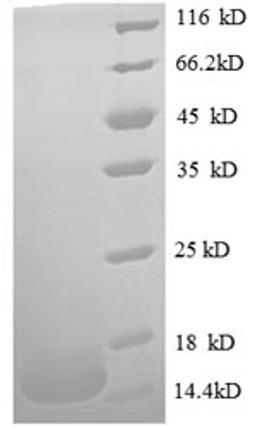 (Tris-Glycine gel) Discontinuous SDS-PAGE (reduced) with 5% enrichment gel and 15% separation gel.