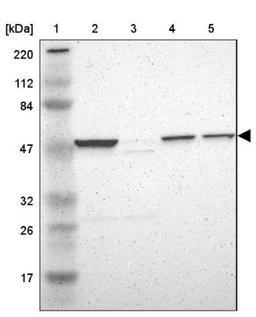 Western Blot: HYAL1 Antibody [NBP1-83409] - Lane 1: Marker [kDa] 220, 112, 84, 47, 32, 26, 17<br/>Lane 2: Human cell line RT-4<br/>Lane 3: Human cell line U-251MG sp<br/>Lane 4: Human liver tissue<br/>Lane 5: Human tonsil tissue