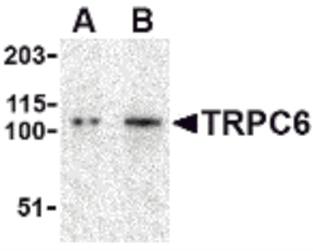 Western blot analysis of TRPC6 in K562 cell lysate with TRPC6 antibody at (A) 0.5 and (B) 1 &#956;g/mL.