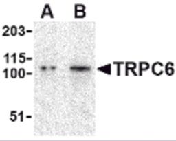 Western blot analysis of TRPC6 in K562 cell lysate with TRPC6 antibody at (A) 0.5 and (B) 1 &#956;g/mL.