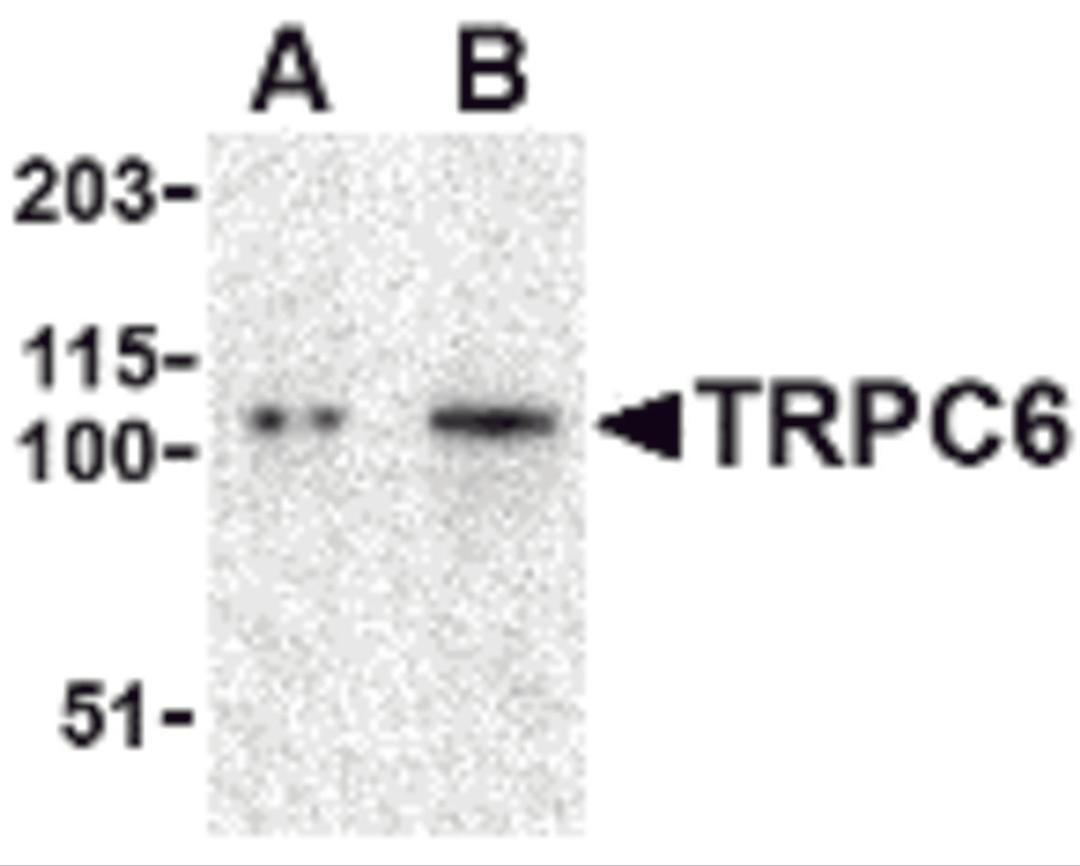 Western blot analysis of TRPC6 in K562 cell lysate with TRPC6 antibody at (A) 0.5 and (B) 1 μg/mL.