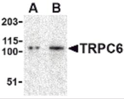 Western blot analysis of TRPC6 in K562 cell lysate with TRPC6 antibody at (A) 0.5 and (B) 1 μg/mL.