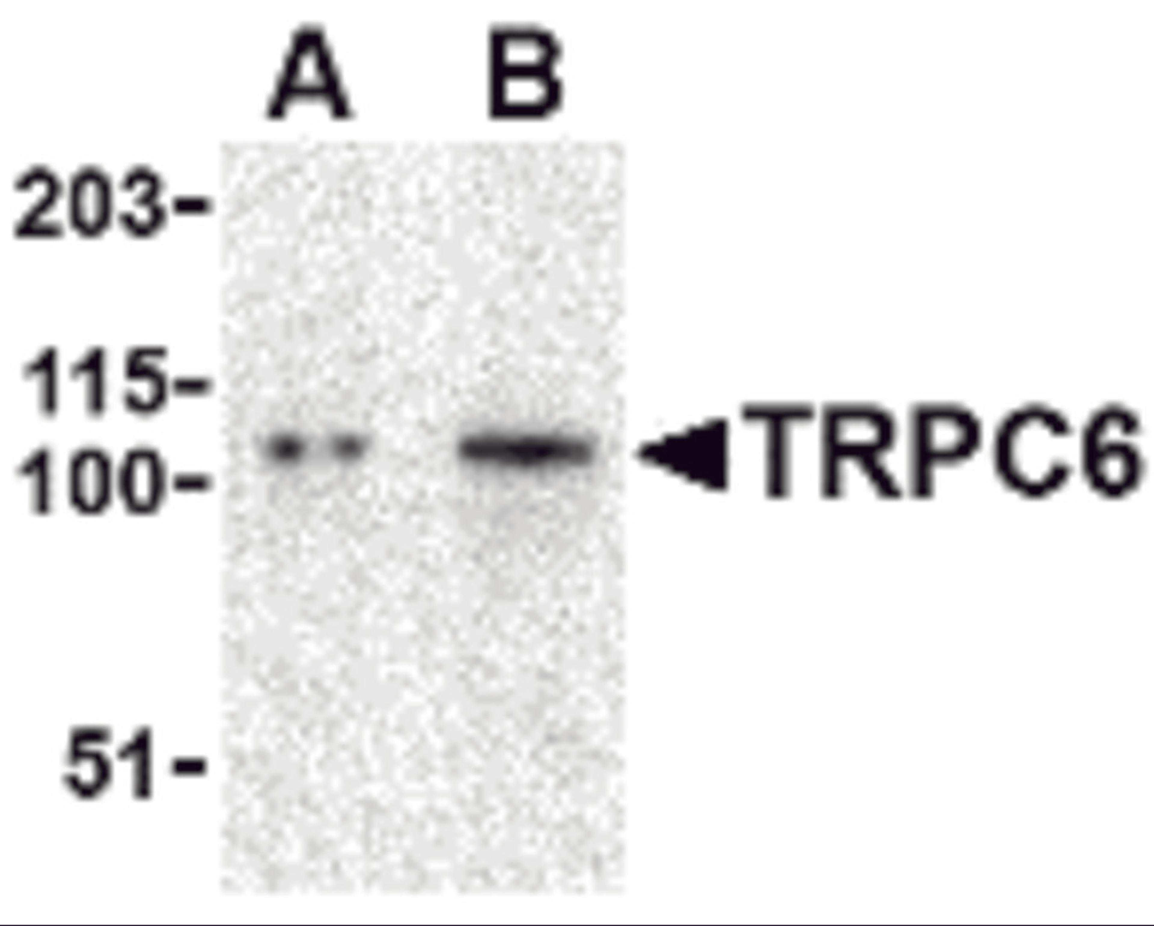 Western blot analysis of TRPC6 in K562 cell lysate with TRPC6 antibody at (A) 0.5 and (B) 1 μg/mL.