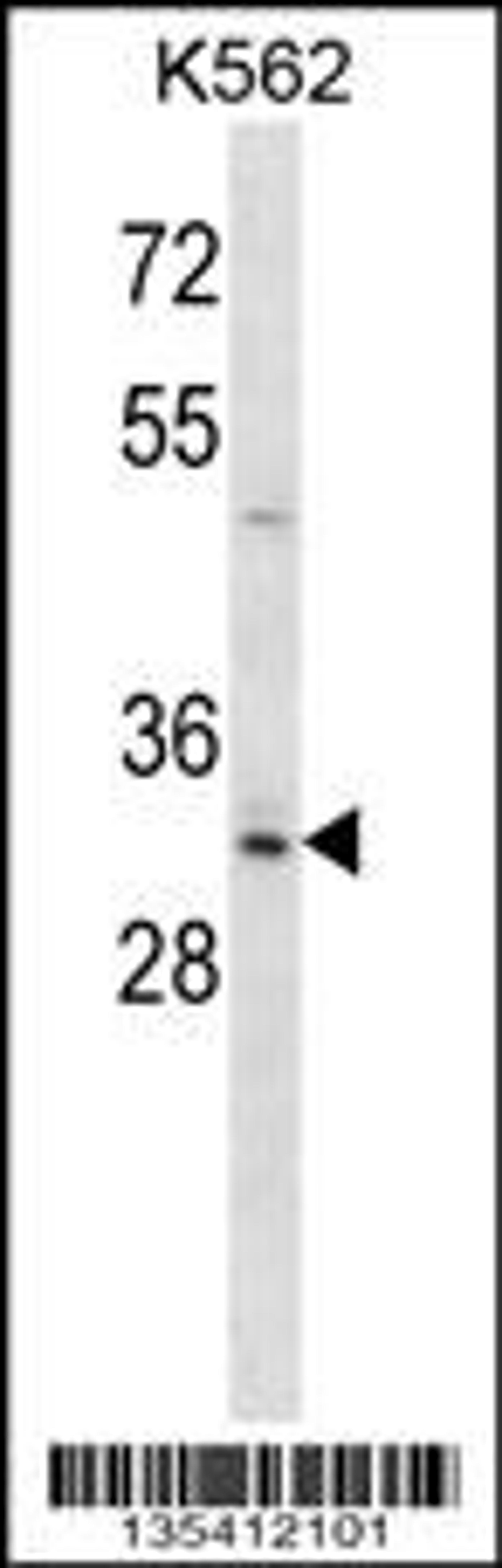 Western blot analysis in K562 cell line lysates (35ug/lane).