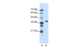 Antibody used in WB on Human HepG2 at 1.25 ug/ml.