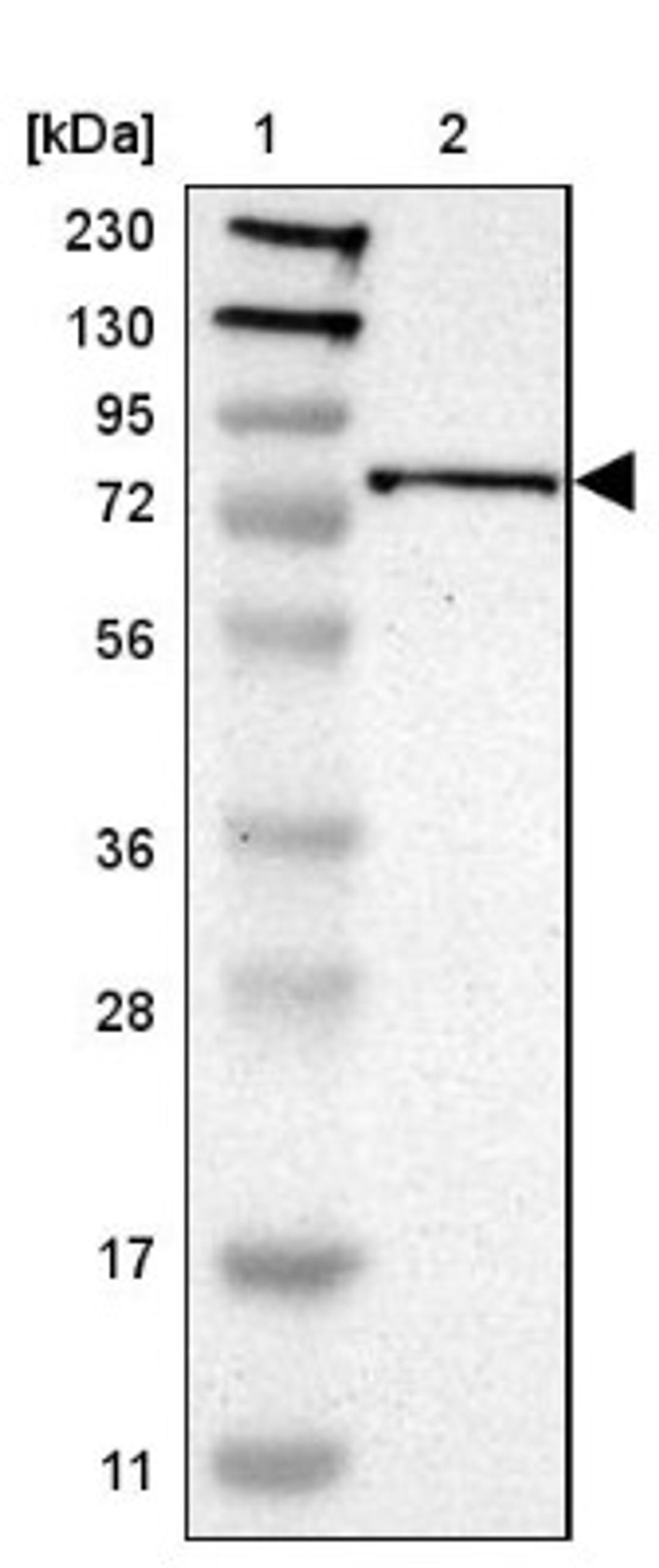 Western Blot: Caldesmon Antibody [NBP1-85702] - Lane 1: Marker [kDa] 230, 130, 95, 72, 56, 36, 28, 17, 11<br/>Lane 2: Human cell line RT-4