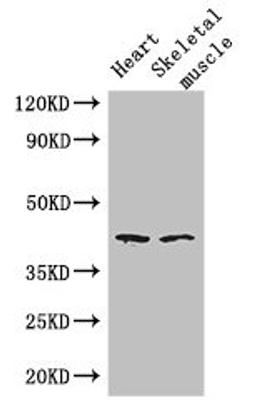 Western Blot. Positive WB detected in: Mouse heart tissue, Mouse skeletal muscle tissue. All lanes: SLC30A7 antibody at 3ug/ml. Secondary. Goat polyclonal to rabbit IgG at 1/50000 dilution. Predicted band size: 42 kDa. Observed band size: 42 kDa. 