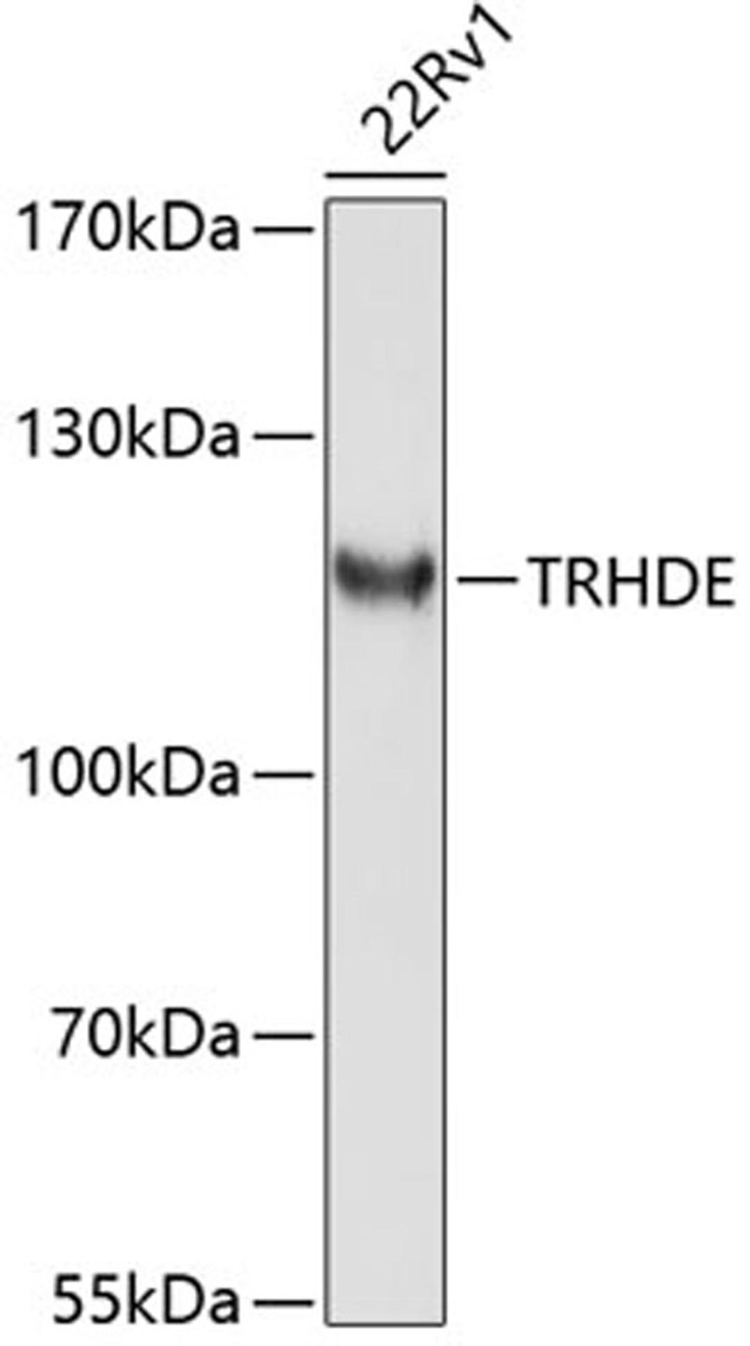 Western blot - TRHDE antibody (A10300)