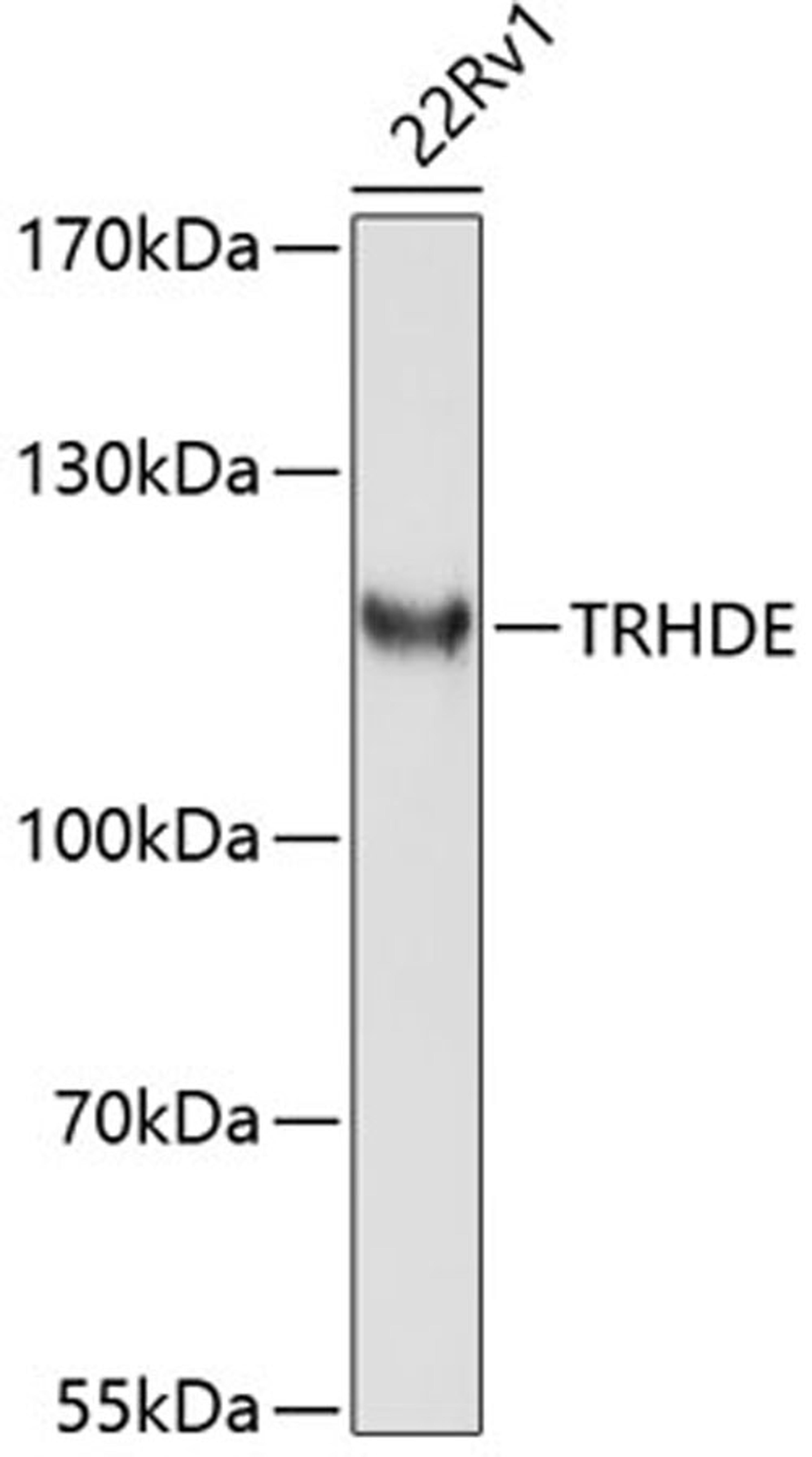 Western blot - TRHDE antibody (A10300)