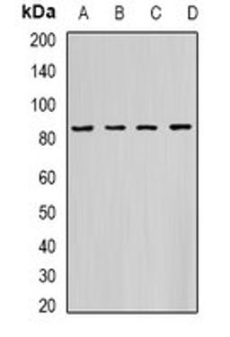 Western blot analysis of K562 (Lane1), PC3 (Lane2), Hela (Lane3), mouse heart (Lane4) whole cell lysates using HADHA antibody