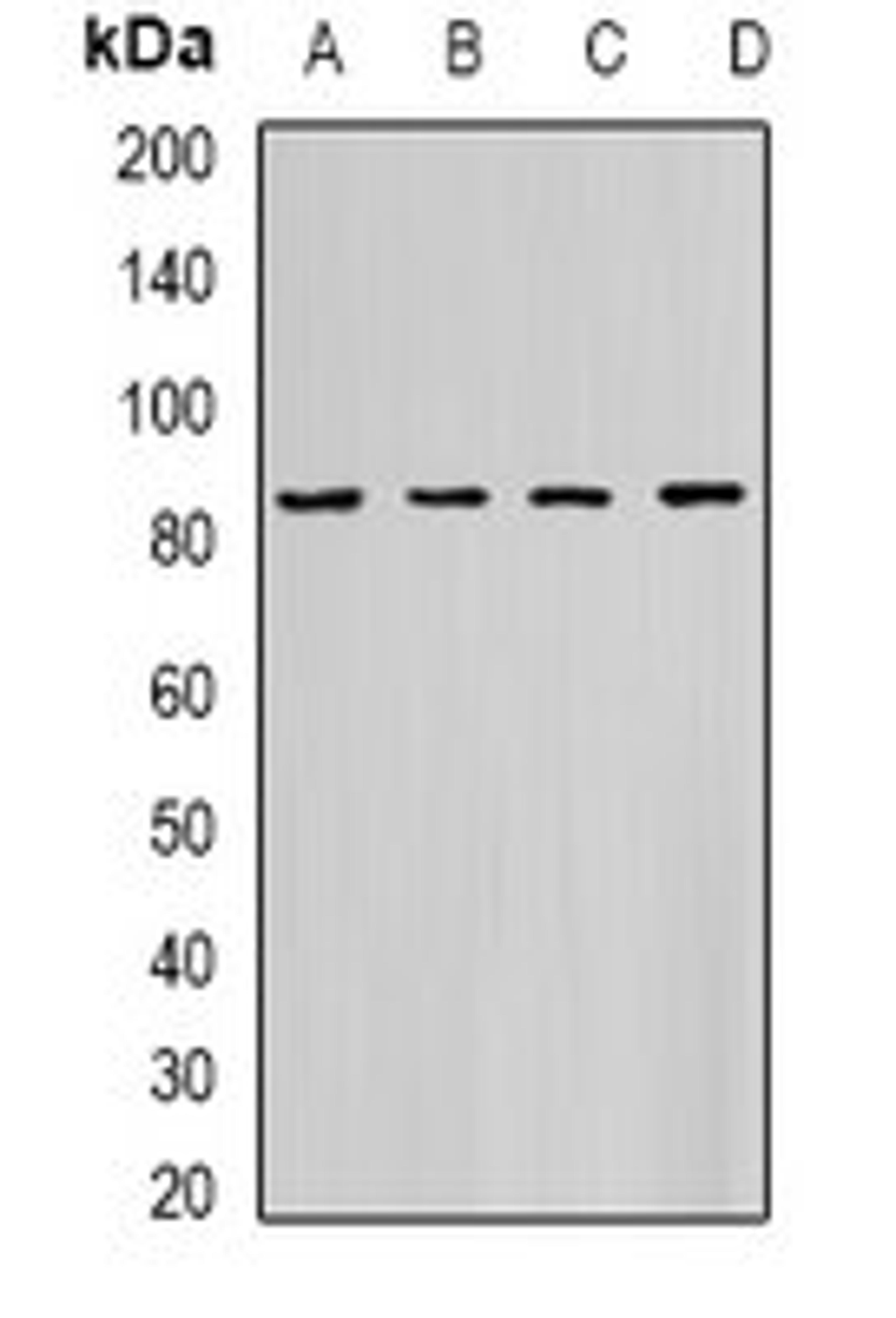 Western blot analysis of K562 (Lane1), PC3 (Lane2), Hela (Lane3), mouse heart (Lane4) whole cell lysates using HADHA antibody