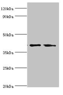 Western blot. All lanes: LGALS9 antibody at 14ug/ml. Lane 1: Hela whole cell lysate. Lane 2: Jurkat whole cell lysate. Secondary. Goat polyclonal to rabbit IgG at 1/10000 dilution. Predicted band size: 40, 36, 35, 27, 26, 39 kDa. Observed band size: 40 kDa. 
