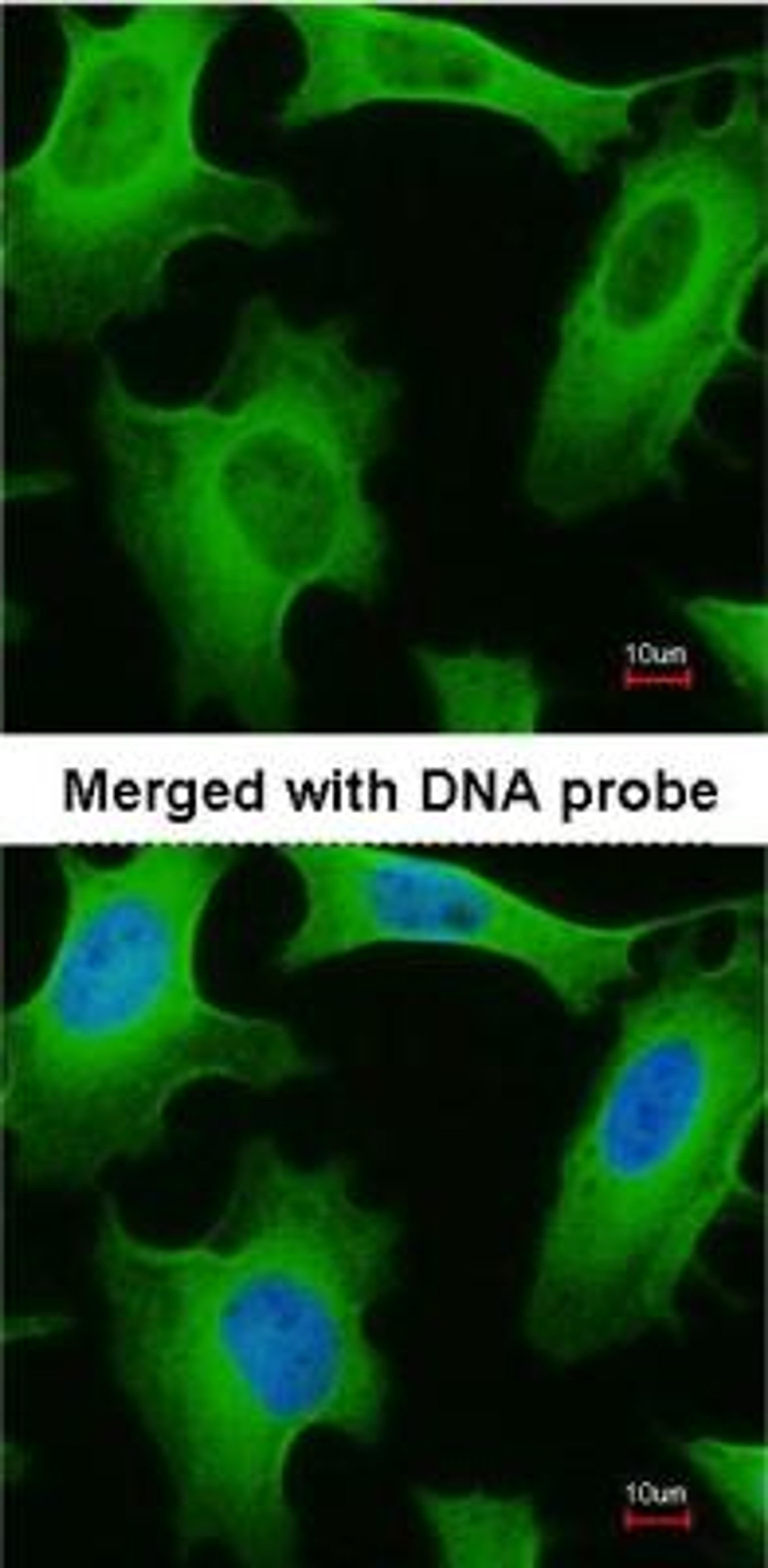 Immunocytochemistry/Immunofluorescence: PLA2G4A Antibody [NBP1-31344] - Analysis of HeLa, using NBP1-31344 at 1:200 dilution.