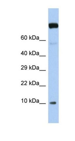 Western blot analysis of human Jurkat tissue using WBP5 antibody