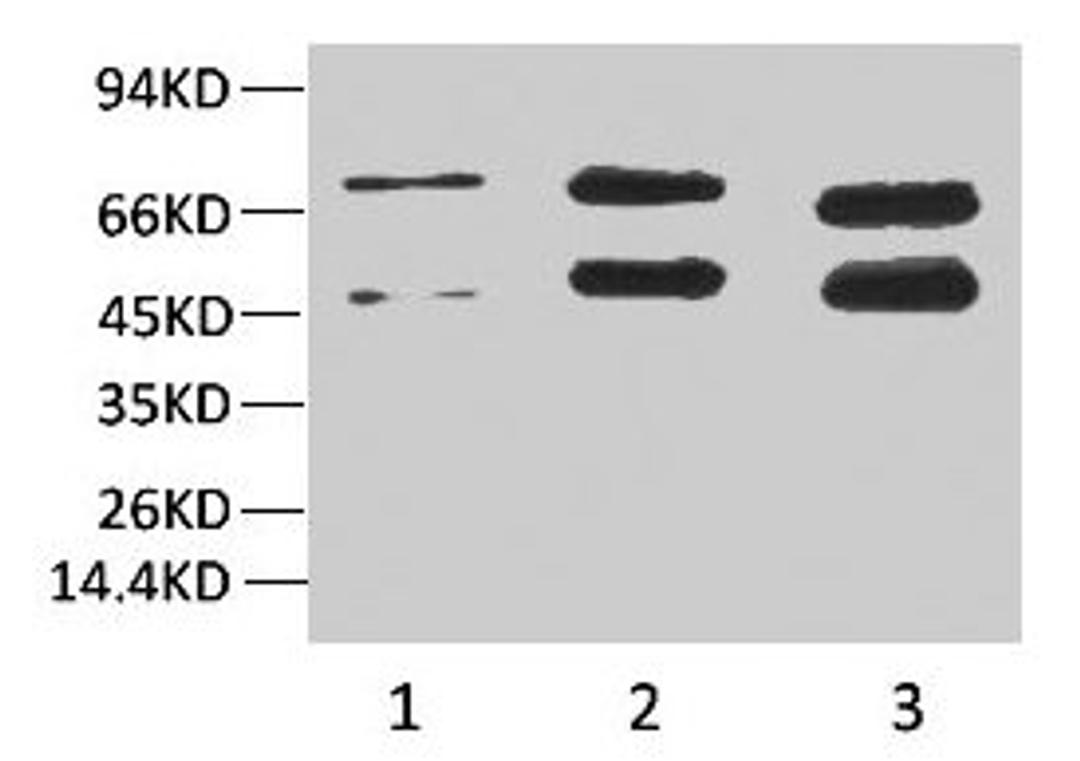 Western blot analysis of 1) Hela, 2)Rat Brain Tissue, 3) Mouse Brain Tissue with Phosphoserine Mouse mAb diluted at 1:2000.