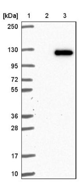 Western Blot: VPS18 Antibody [NBP1-82906] - Lane 1: Marker [kDa] 250, 130, 95, 72, 55, 36, 28, 17, 10<br/>Lane 2: Negative control (vector only transfected HEK293T lysate)<br/>Lane 3: Over-expression lysate (Co-expressed with a C-terminal myc-DDK tag (~3.1 kDa) in mammalian HEK293T cells, LY412275)