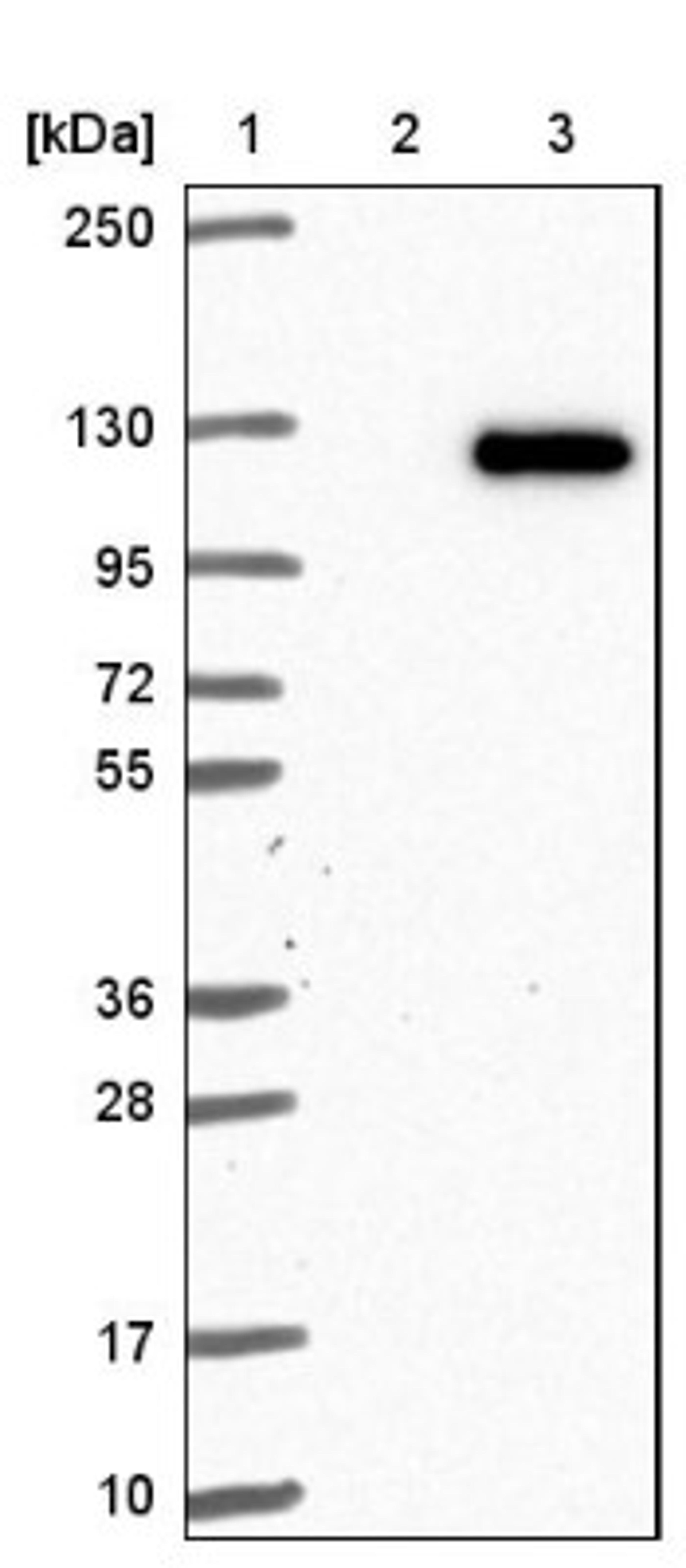 Western Blot: VPS18 Antibody [NBP1-82906] - Lane 1: Marker [kDa] 250, 130, 95, 72, 55, 36, 28, 17, 10<br/>Lane 2: Negative control (vector only transfected HEK293T lysate)<br/>Lane 3: Over-expression lysate (Co-expressed with a C-terminal myc-DDK tag (~3.1 kDa) in mammalian HEK293T cells, LY412275)