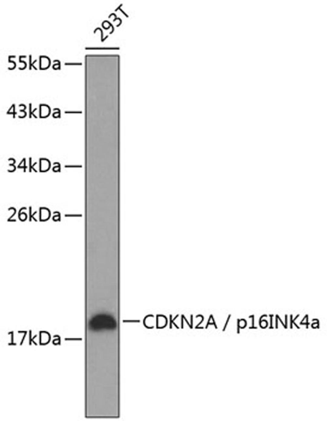 Western blot - CDKN2A / p16INK4a antibody (A11058)