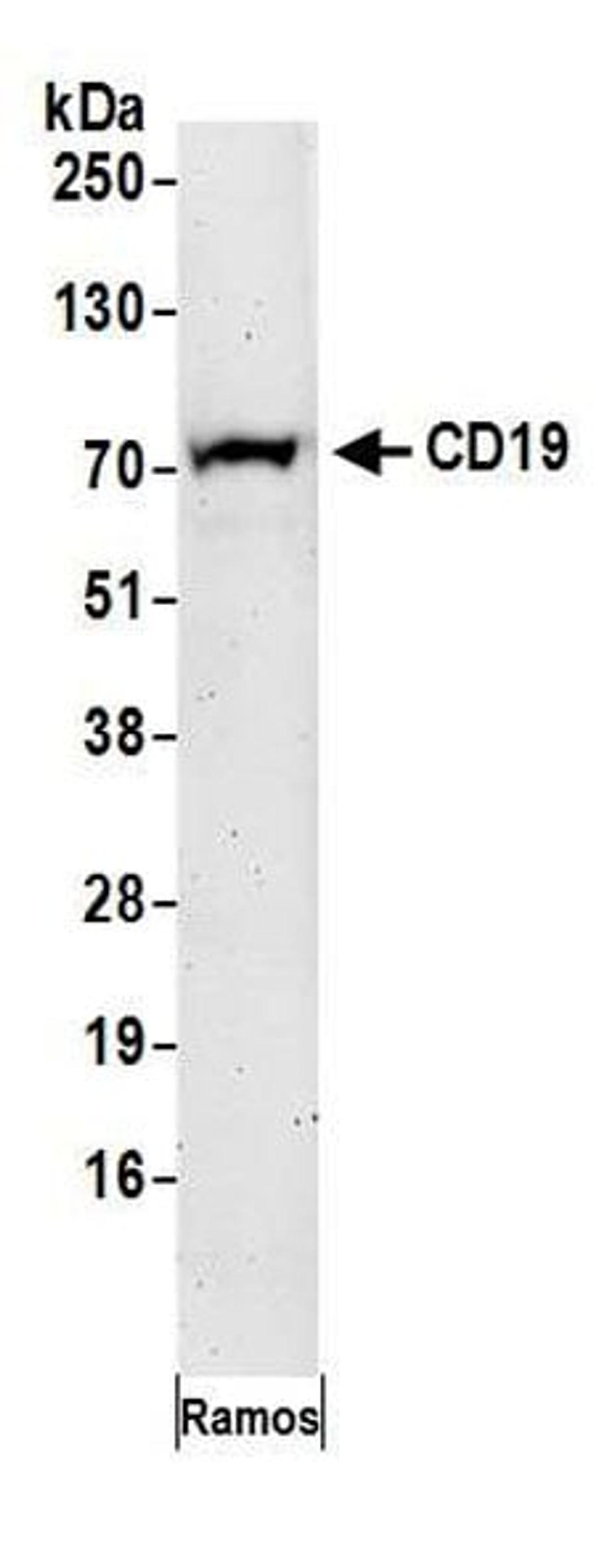 Detection of human CD19 by western blot.