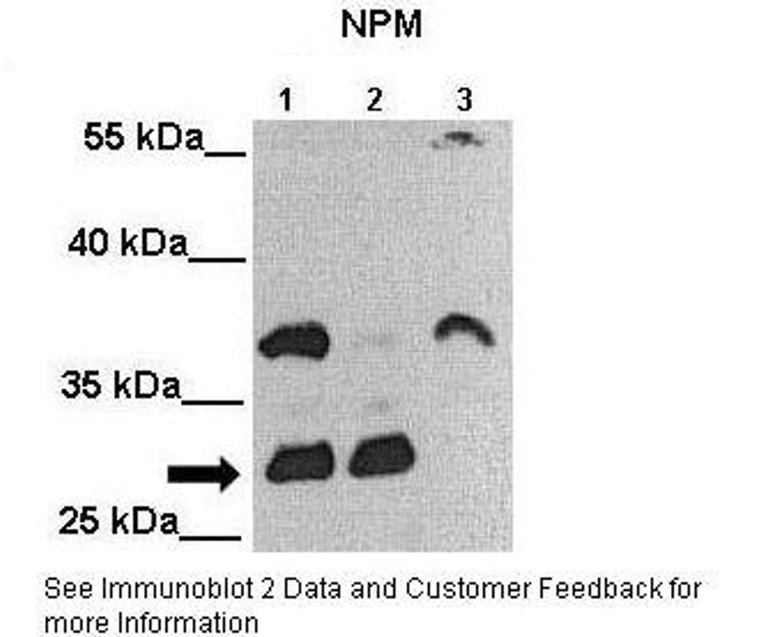 Antibody used in WB on Human cell lines at: 1:2000 (Lane 1: 25ug MIA PaCa-2 cell lysate, Lane 2: 25ug MDA-MB-231 cell lysate, Lane 3: 25ug Huh-7 cell lysate).