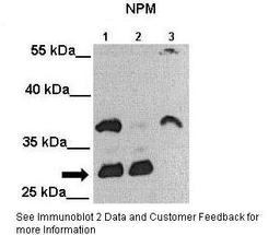 Antibody used in WB on Human cell lines at: 1:2000 (Lane 1: 25ug MIA PaCa-2 cell lysate, Lane 2: 25ug MDA-MB-231 cell lysate, Lane 3: 25ug Huh-7 cell lysate).