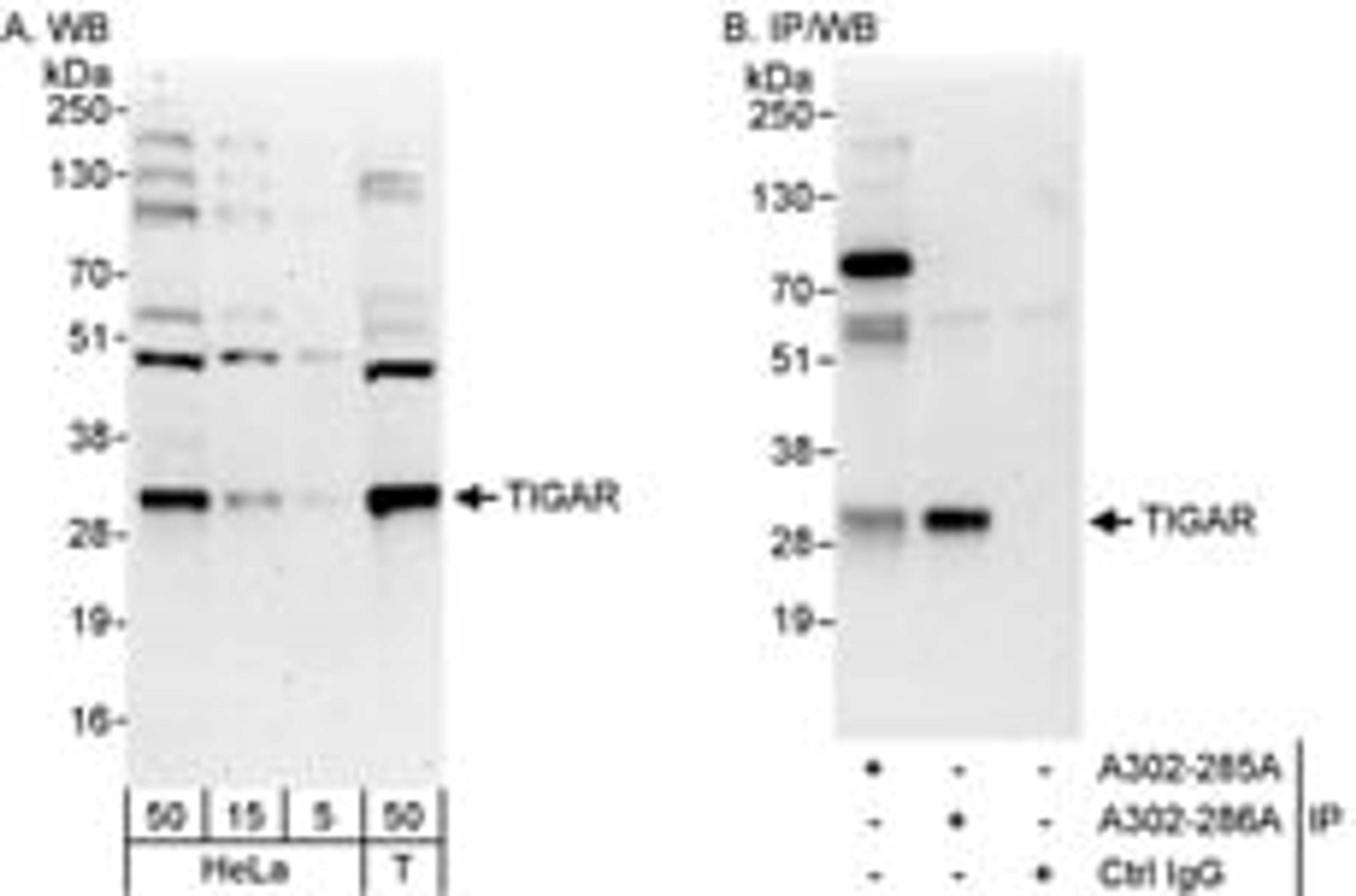 Detection of human TIGAR by western blot and immunoprecipitation.