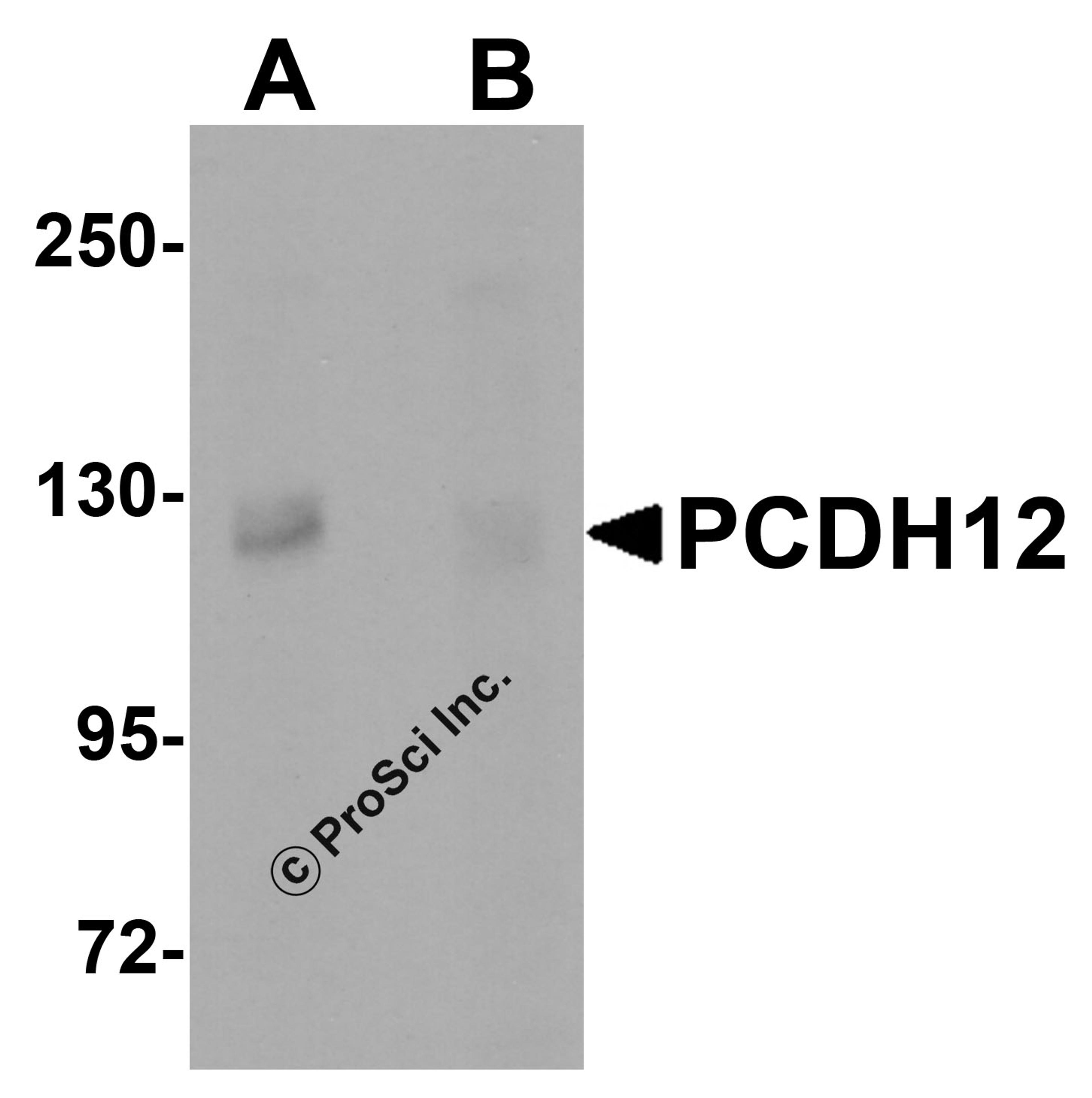 Western blot analysis of PCDH12 in K562 cell lysate with PCDH12 antibody at 1 μg/mL in (A) the absence and (B) the presence of blocking peptide.