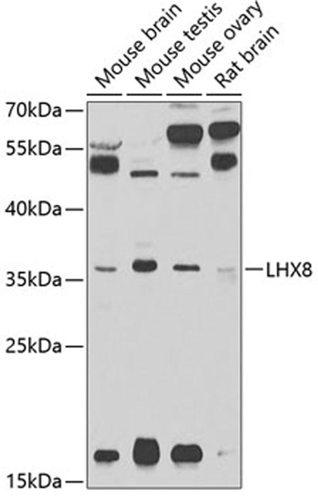 Western blot - LHX8 antibody (A2046)