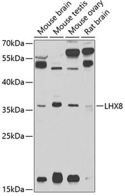 Western blot - LHX8 antibody (A2046)