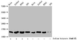 Western Blot. Detected samples: Hela whole cell lysate, Jurkat whole cell lysate, K562 whole cell lysate, 293 whole cell lysate; Untreated (-) or treated (+) with 30mM sodium butyrate for 4h. All lanes: HIST1H2BC antibody at 1:500. Secondary. Goat polyclonal to rabbit IgG at 1/40000 dilution. Predicted band size: 14 kDa. Observed band size: 14 kDa