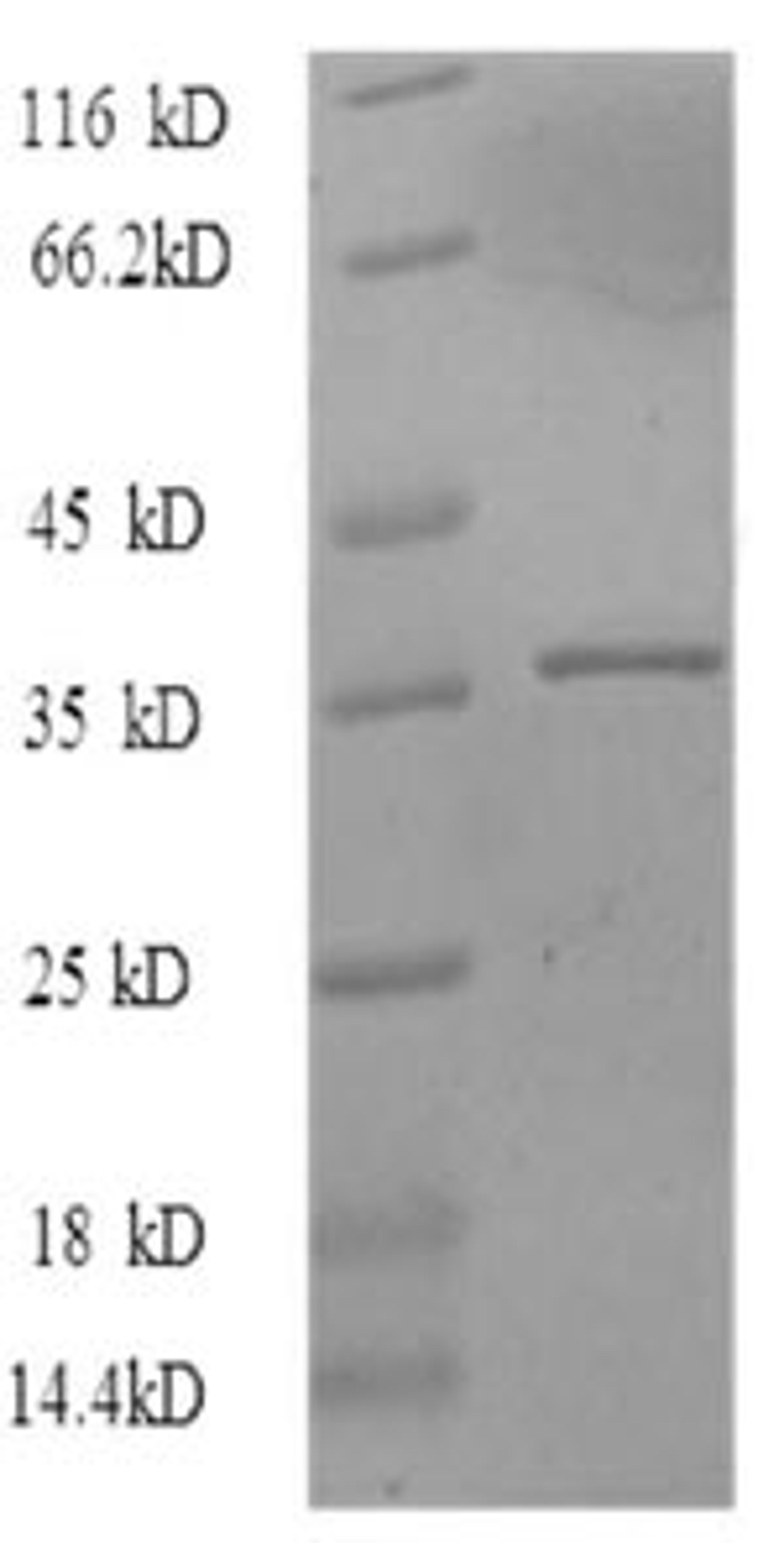 (Tris-Glycine gel) Discontinuous SDS-PAGE (reduced) with 5% enrichment gel and 15% separation gel.