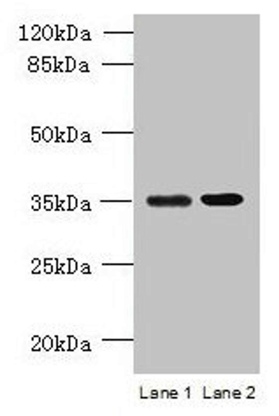 Western blot. All lanes: CFAP65 antibody at 8µg/ml. Lane 1: U251 whole cell lysate. Lane 2: U87 whole cell lysate. Secondary. Goat polyclonal to rabbit IgG at 1/10000 dilution. Predicted band size: 218, 19, 82, 88 kDa. Observed band size: 35 kDa