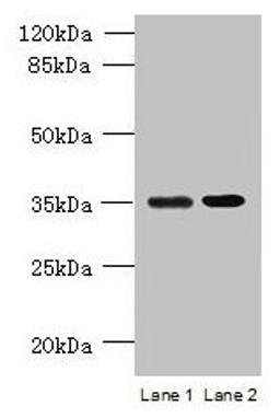Western blot. All lanes: CFAP65 antibody at 8µg/ml. Lane 1: U251 whole cell lysate. Lane 2: U87 whole cell lysate. Secondary. Goat polyclonal to rabbit IgG at 1/10000 dilution. Predicted band size: 218, 19, 82, 88 kDa. Observed band size: 35 kDa
