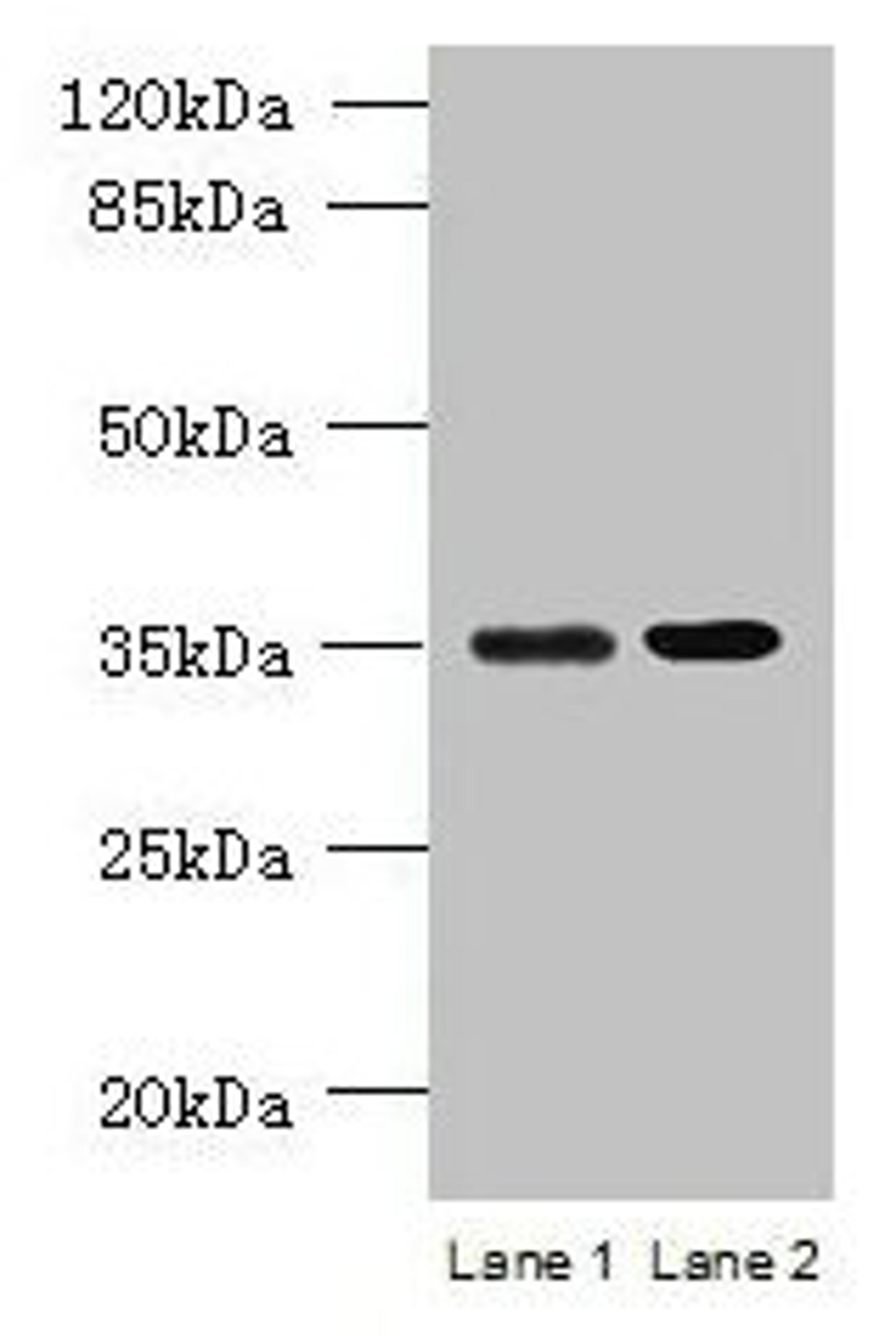 Western blot. All lanes: CFAP65 antibody at 8µg/ml. Lane 1: U251 whole cell lysate. Lane 2: U87 whole cell lysate. Secondary. Goat polyclonal to rabbit IgG at 1/10000 dilution. Predicted band size: 218, 19, 82, 88 kDa. Observed band size: 35 kDa