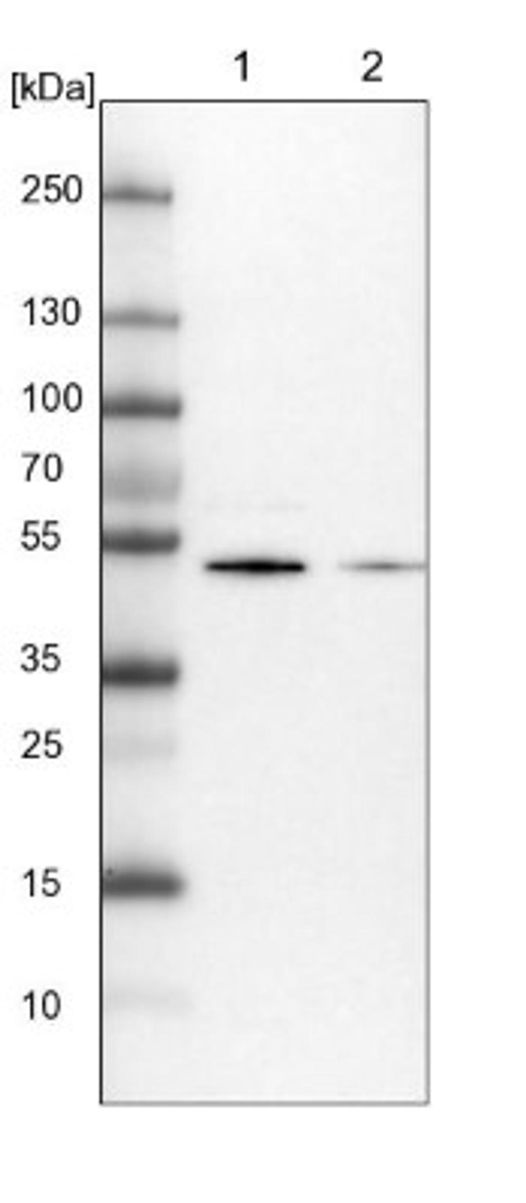 Western Blot: PHYHIPL Antibody [NBP1-84858] - Lane 1: NIH-3T3 cell lysate (Mouse embryonic fibroblast cells)<br/>Lane 2: NBT-II cell lysate (Rat Wistar bladder tumour cells)