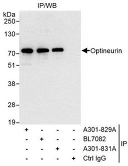 Detection of human Optineurin by western blot of immunoprecipitates.