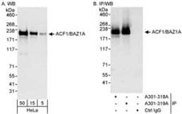 Detection of human ACF1/BAZ1A by western blot and immunoprecipitation.