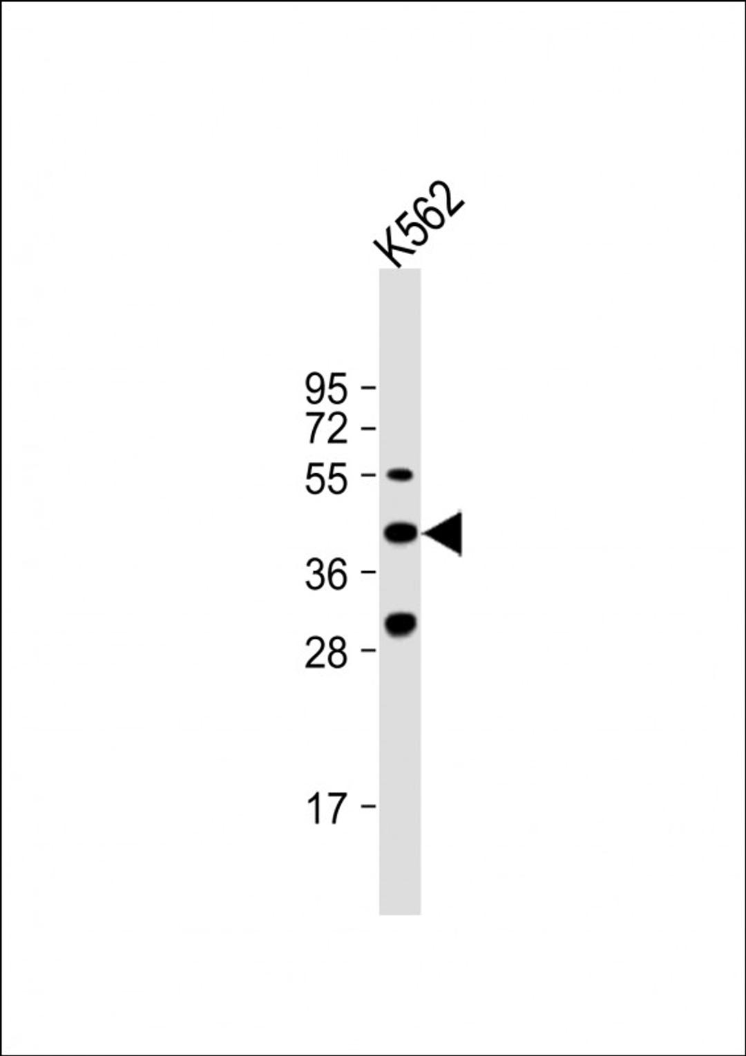 Western Blot at 1:1000 dilution + K562 whole cell lysate Lysates/proteins at 20 ug per lane.