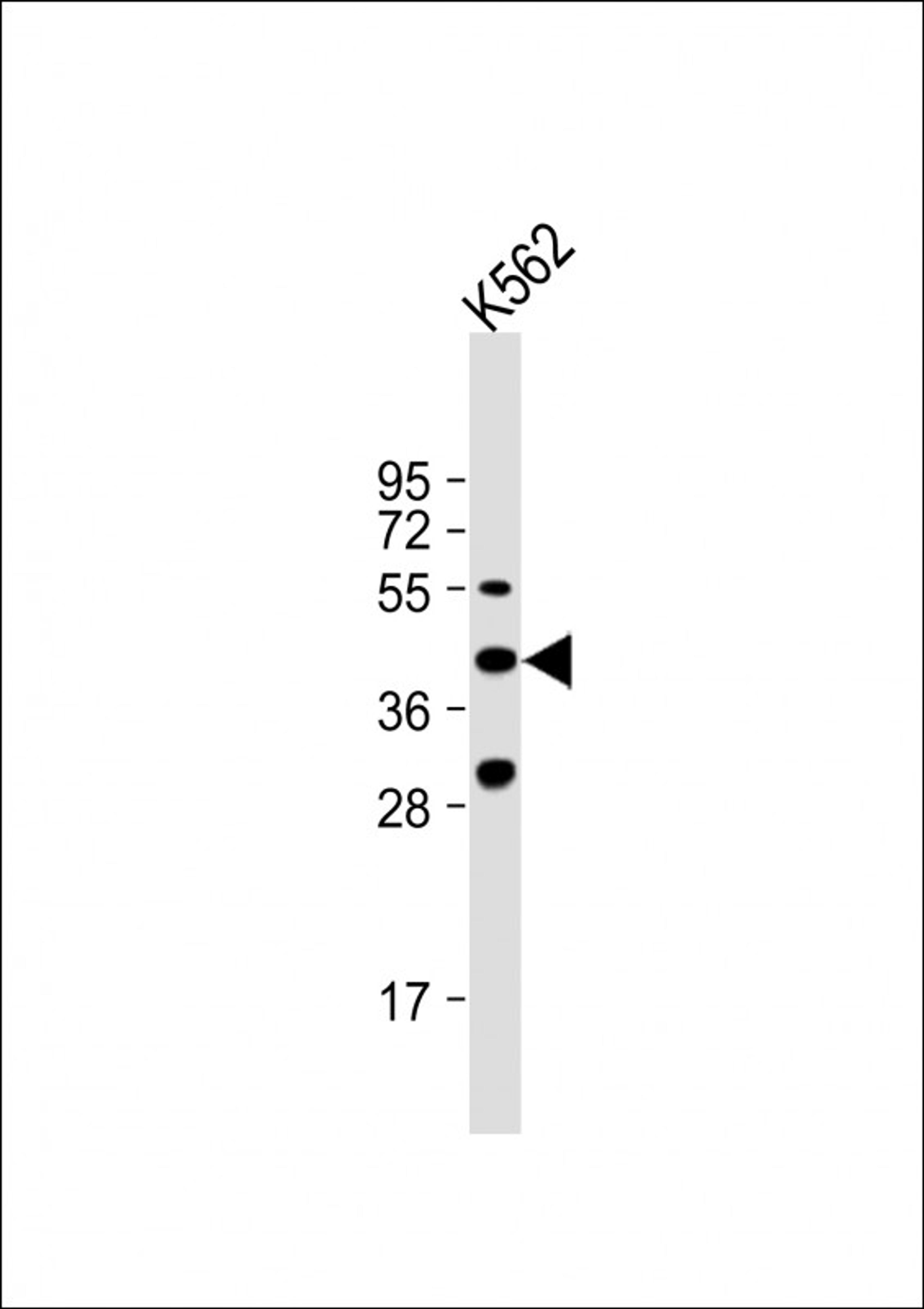 Western Blot at 1:1000 dilution + K562 whole cell lysate Lysates/proteins at 20 ug per lane.