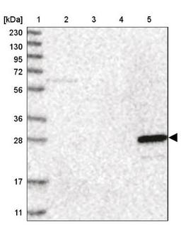 Western Blot: Grancalcin Antibody [NBP1-89785] - Lane 1: Marker [kDa] 230, 130, 95, 72, 56, 36, 28, 17, 11<br/>Lane 2: Human cell line RT-4<br/>Lane 3: Human cell line U-251MG sp<br/>Lane 4: Human plasma (IgG/HSA depleted)<br/>Lane 5: Human liver tissue