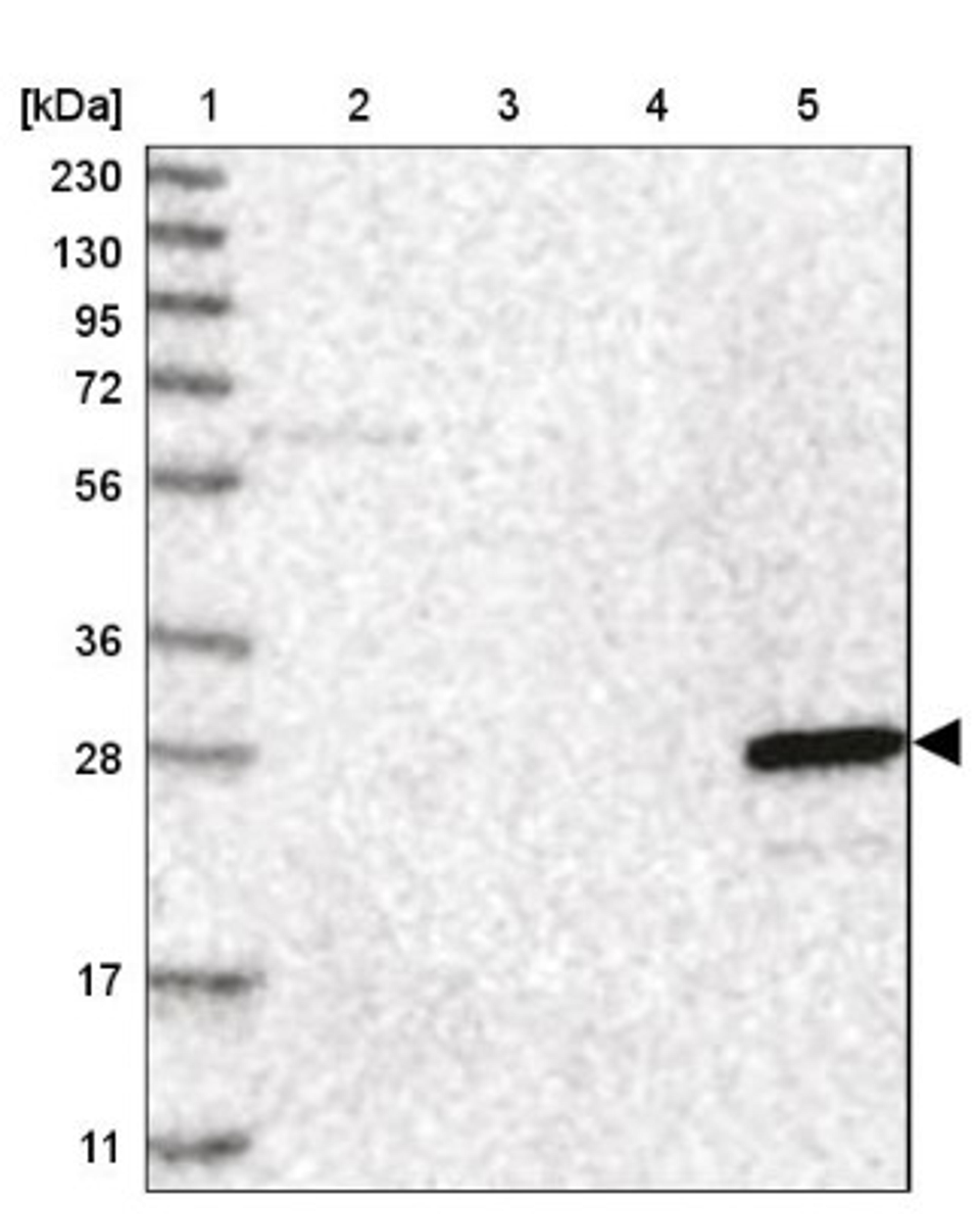 Western Blot: Grancalcin Antibody [NBP1-89785] - Lane 1: Marker [kDa] 230, 130, 95, 72, 56, 36, 28, 17, 11<br/>Lane 2: Human cell line RT-4<br/>Lane 3: Human cell line U-251MG sp<br/>Lane 4: Human plasma (IgG/HSA depleted)<br/>Lane 5: Human liver tissue