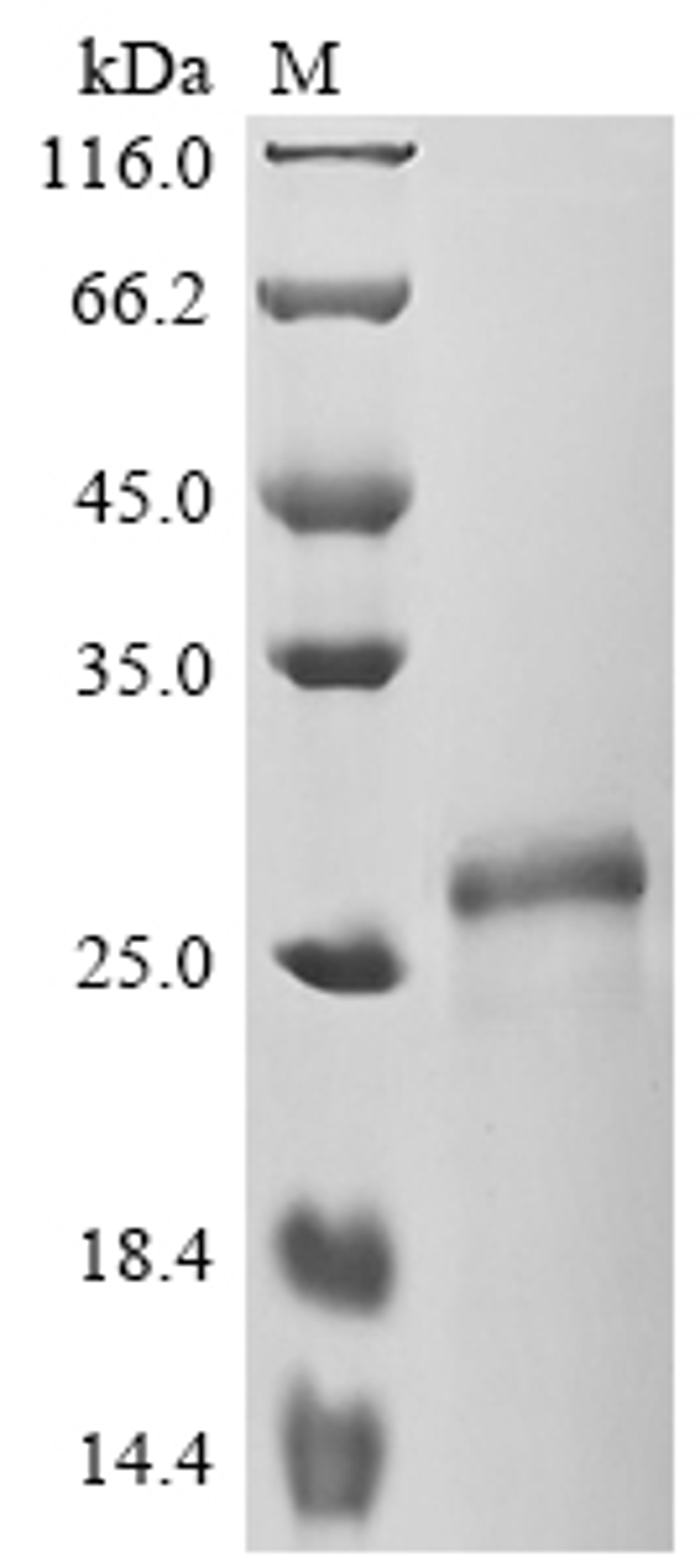 (Tris-Glycine gel) Discontinuous SDS-PAGE (reduced) with 5% enrichment gel and 15% separation gel.