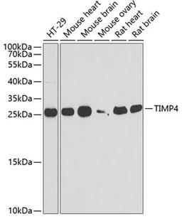 Western blot - TIMP4 antibody (A6416)