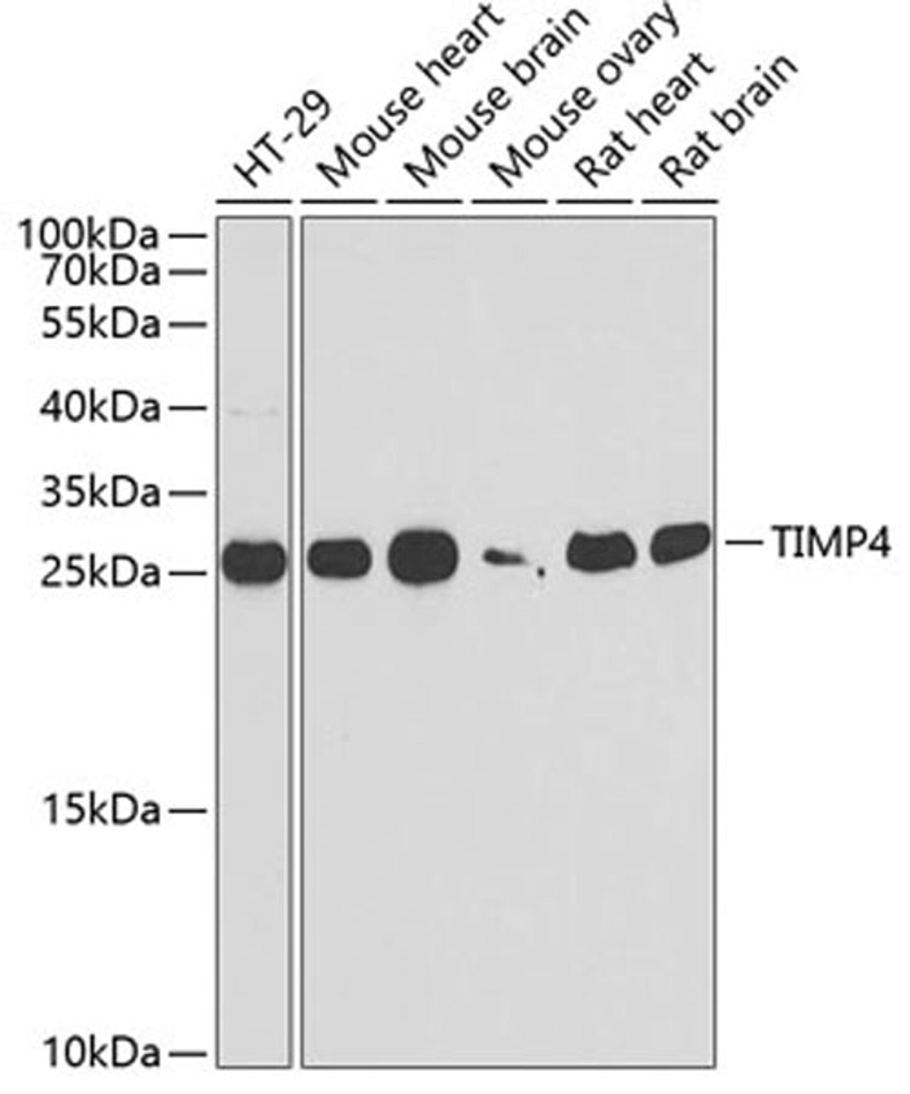 Western blot - TIMP4 antibody (A6416)