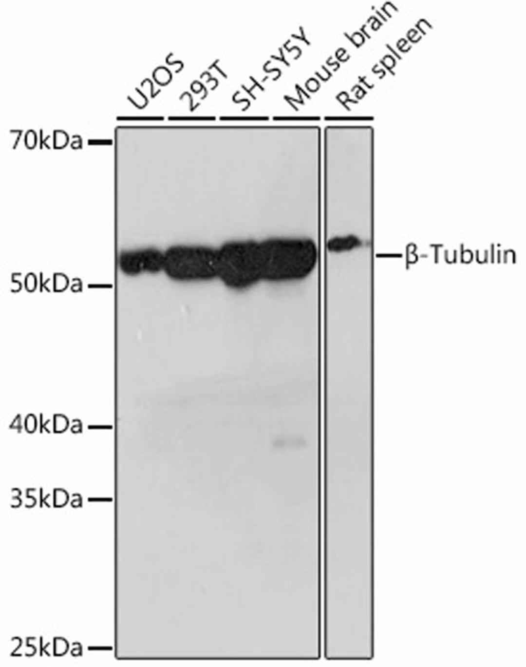 Western blot - ß-Tubulin Rabbit mAb (A12289)