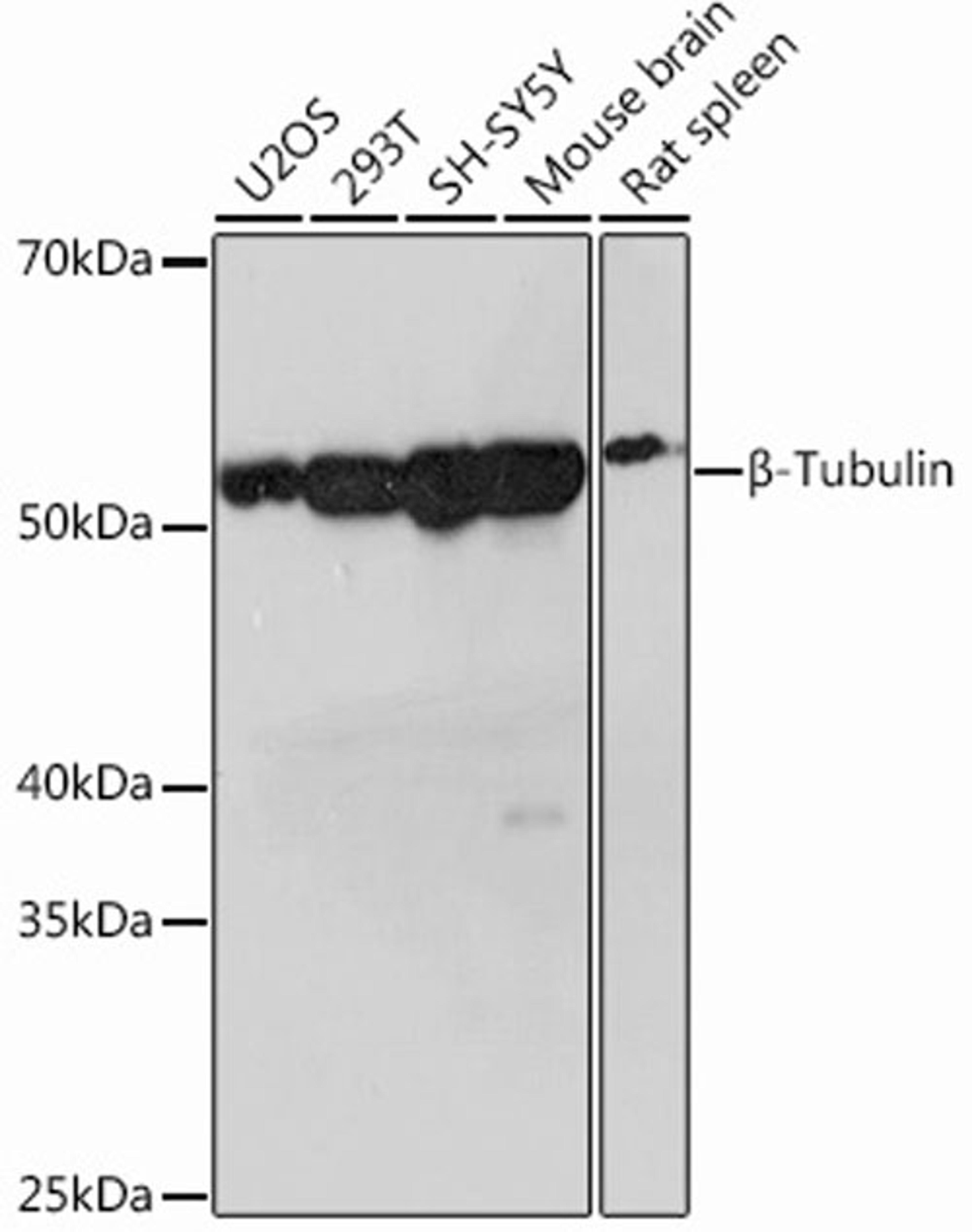 Western blot - ß-Tubulin Rabbit mAb (A12289)