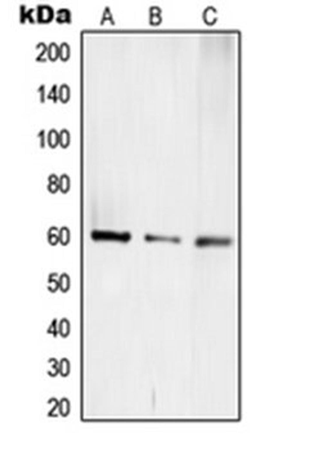 Western blot analysis of Jurkat (Lane 1), mouse kidney (Lane 2), rat kidney (Lane 3) whole cell lysates using TCEB3C antibody