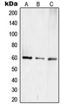 Western blot analysis of Jurkat (Lane 1), mouse kidney (Lane 2), rat kidney (Lane 3) whole cell lysates using TCEB3C antibody