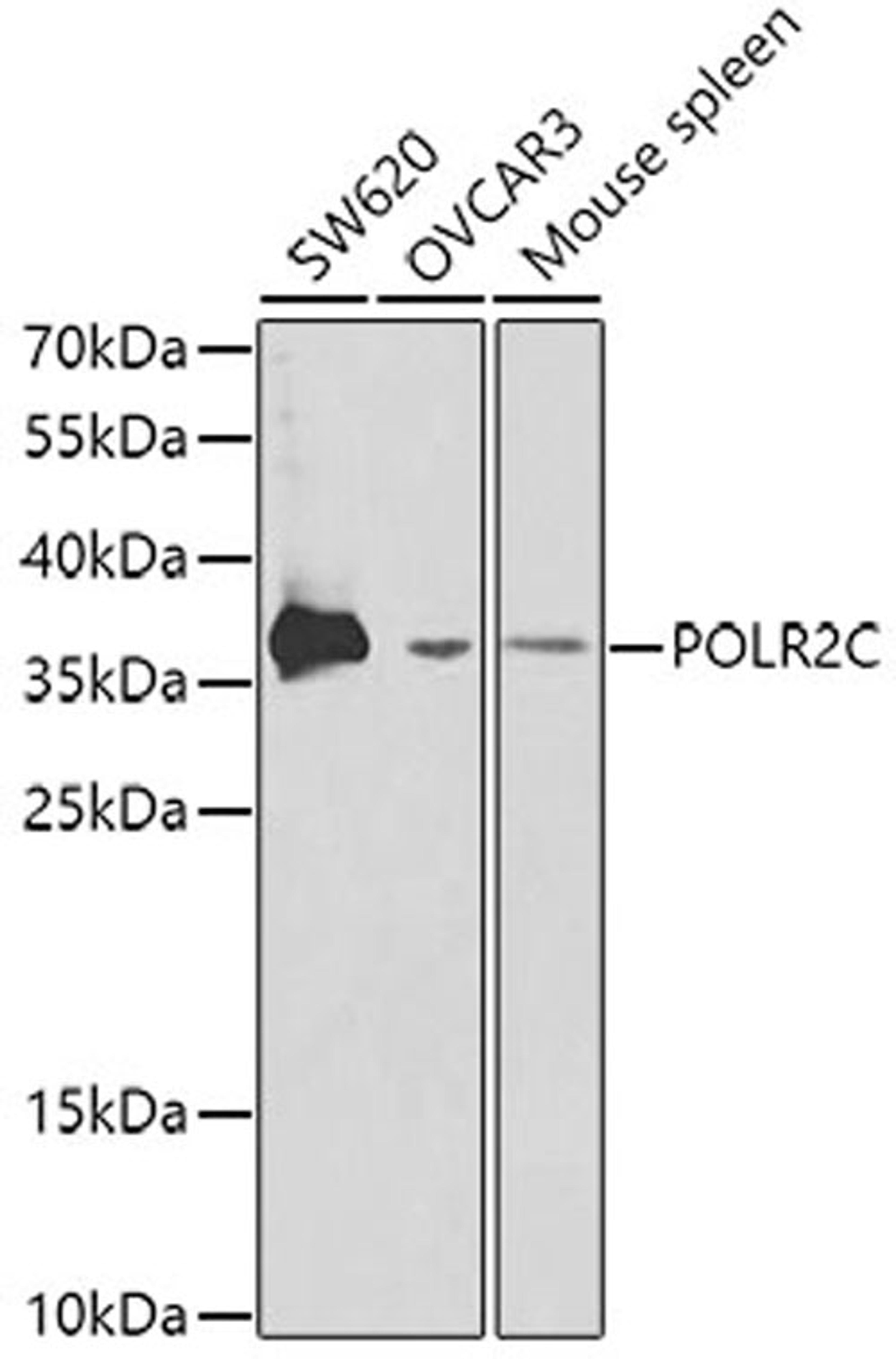 Western blot - POLR2C antibody (A1785)